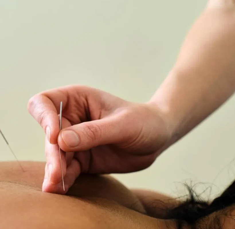 Slider_DryNeedling_01-e173413307